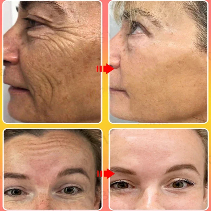 Magic Anti Wrinkle Face Cream Instant Lifting Firming Anti-Aging