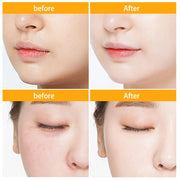 30Pcs Hyaluronic Acid Capsules Serum Hydrating Repair Moisturizing Essence Liquid Facial