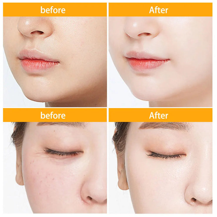 30Pcs Hyaluronic Acid Capsules Serum Hydrating Repair Moisturizing Essence Liquid Facial